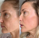 BEE FACTOR LIFTING SERUM ΧΑΒΙΑΡΙ ΜΕ ΥΑΛΟΥΡOΝΙΚΟ & MAJESTEM – 30ML - Image 2